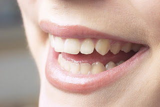 smileteeth