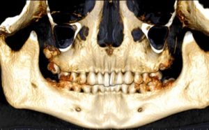 dental scan teeth and jaw