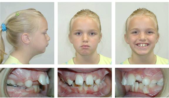 Phases of Orthodontic Treatment