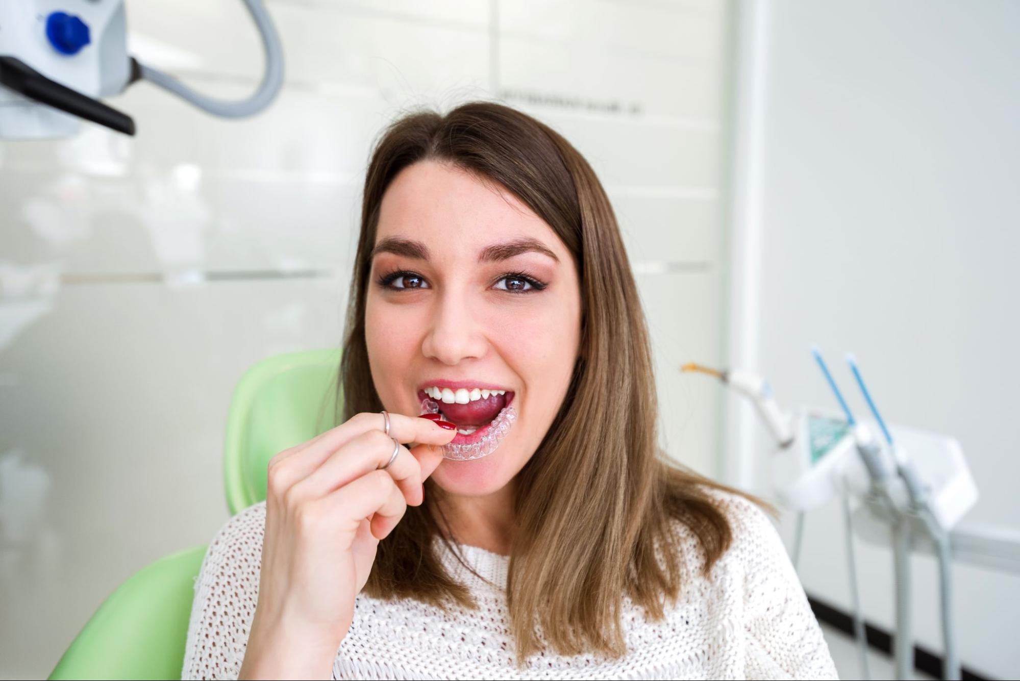Why Are Clear Aligners in Lakewood So Popular?